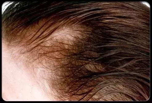 长头发不会编头发怎么办,为什么编头发总是编不好