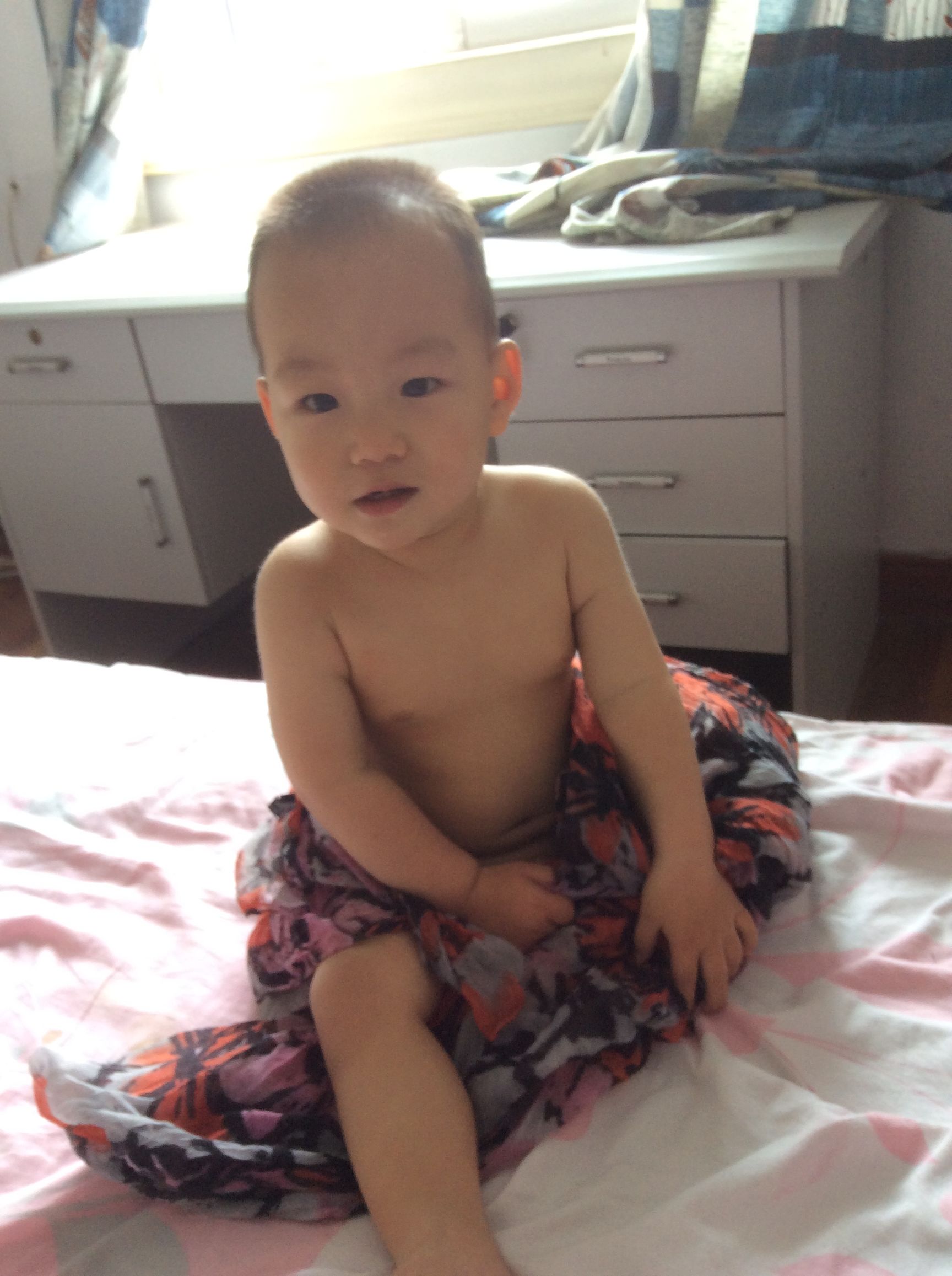 如何预防婴儿湿疹最好方法,孕期怎么防止婴儿湿疹