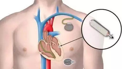 澳洲发明十大神器,澳洲十大发明