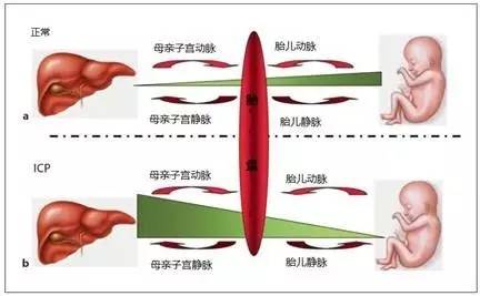 孕期皮肤瘙痒溃烂影响胎儿吗,孕期皮肤刺痛胆汁淤积