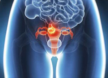 做阴式b超时特别疼,做阴式b超时出血