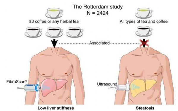 什么时候喝咖啡对肝脏最好,喝咖啡可以让肝脏排毒吗