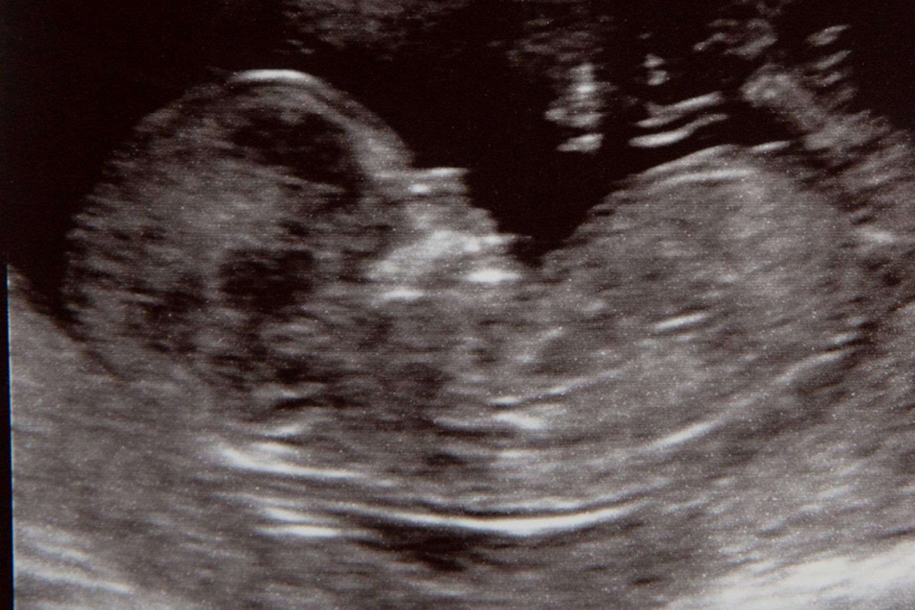 孕期准妈妈需要做什么检查,准妈妈必看孕期运动注意事项