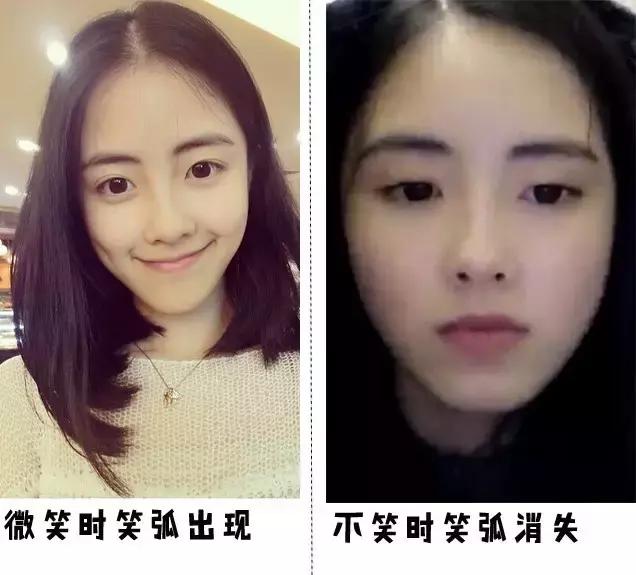 听说爱笑的女孩子法令纹都很深,爱笑的女孩真的容易得法令纹吗