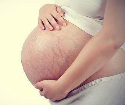 Angelababy产后素颜出席活动，身体这一部位足以看出她生过孩子，网友指责黄晓明