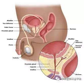 前列腺增生的健康科普,科普1分钟自查前列腺增生