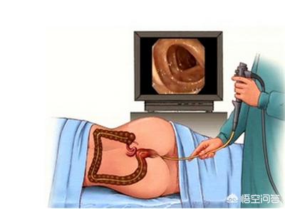 肠镜检查，肛肠检查。。。会不会很尴尬啊