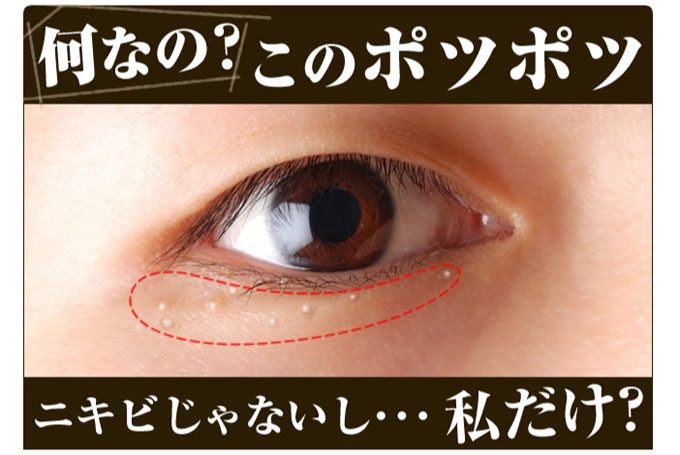 能够有效清除脂肪的药物,去除最顽固脂肪的神奇脂肪去除剂