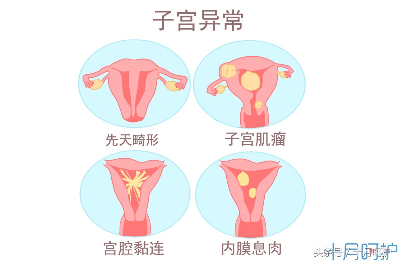 做孕妇的焦虑,孕妇做什么事情容易流产