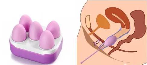 男性盆底松弛是怎么造成的,盆底松弛引起便秘吃什么药