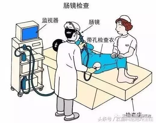 肠镜检查注意事项及肠道准备方法,肠镜检查注意事项科普