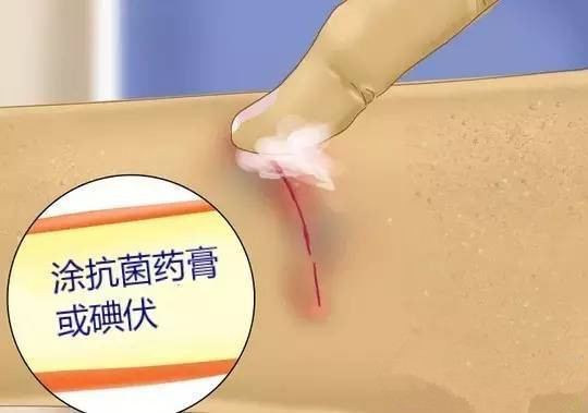 宝宝摔倒的伤疤怎样不留疤痕,宝宝摔倒怎么不留疤