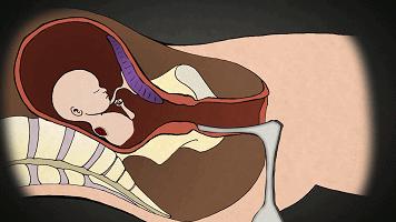LAN《性、安全、录像带》