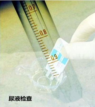 尿检指标科学解读！