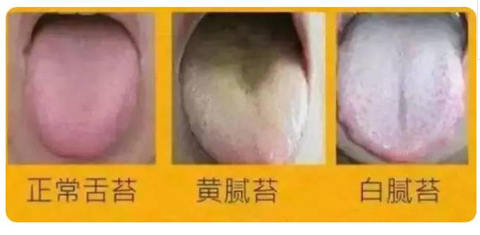 夏季怎样除身体湿气,夏天体内湿气容易加重吗