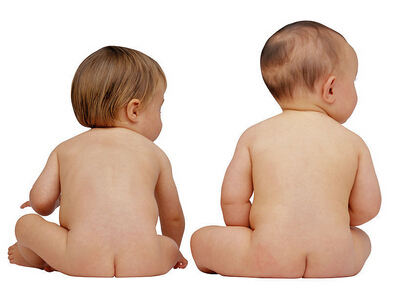 夏季幼儿祛痱止痒,儿童夏季祛痱止痒