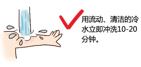 宝宝手指烫伤起水泡怎么办,宝宝屁屁烫伤怎么办