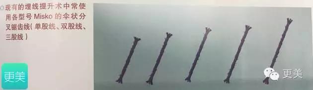 埋线美容线和不吸收线有什么区别,医院埋线和美容院埋线有什么差别