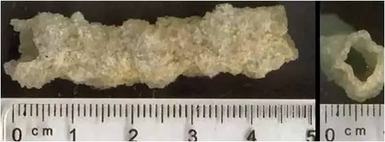 为什么要说瘦成一道闪电,什么时候才能瘦成一道闪电