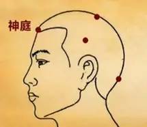 顽固性失眠，不妨试试针灸