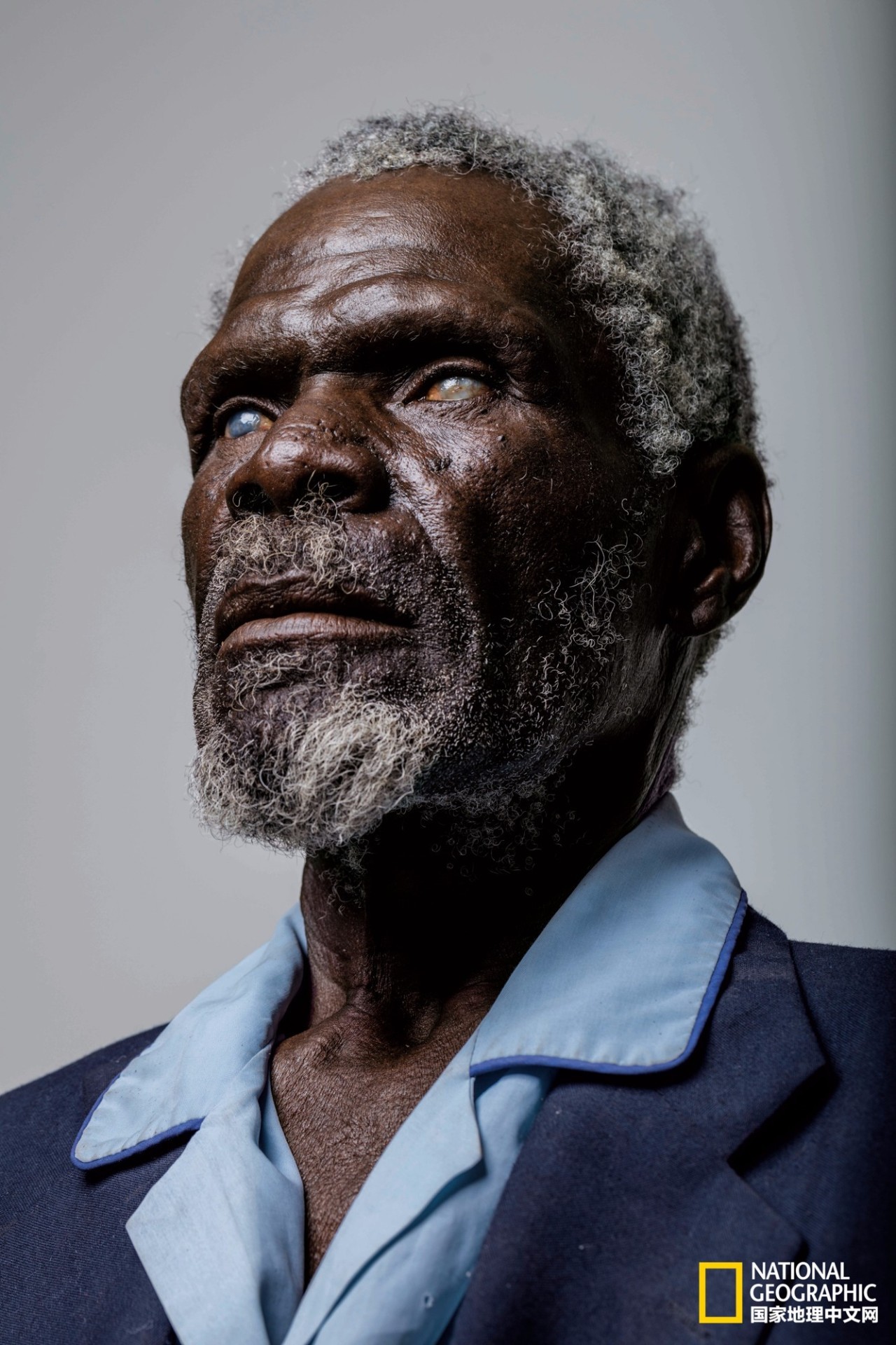 这完全不是科幻片！仿生义眼、干细胞移植、基因疗法……盲症也许马上就要被终结了！