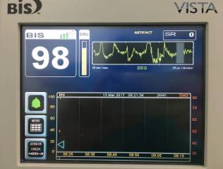 围手术期个案护理比赛优秀案例ppt,术后镇痛的规范化管理ppt