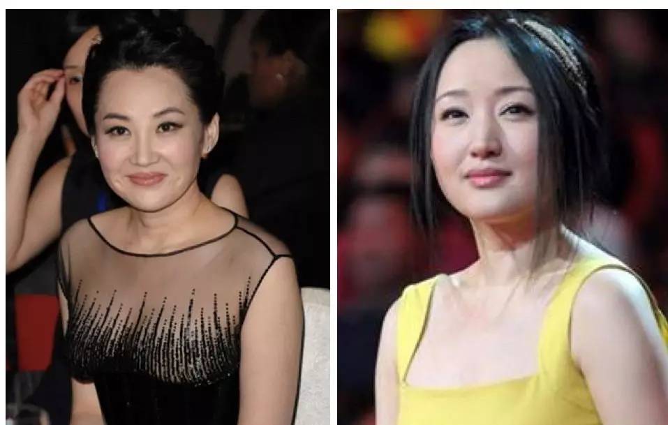 泪沟法令纹颈纹显老怎么办,改善泪沟法令纹全脸提升的方法