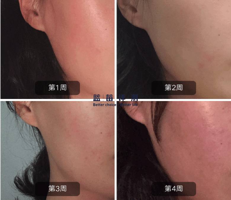 十大公认最好的美容仪,公认最好的美容仪推荐一下