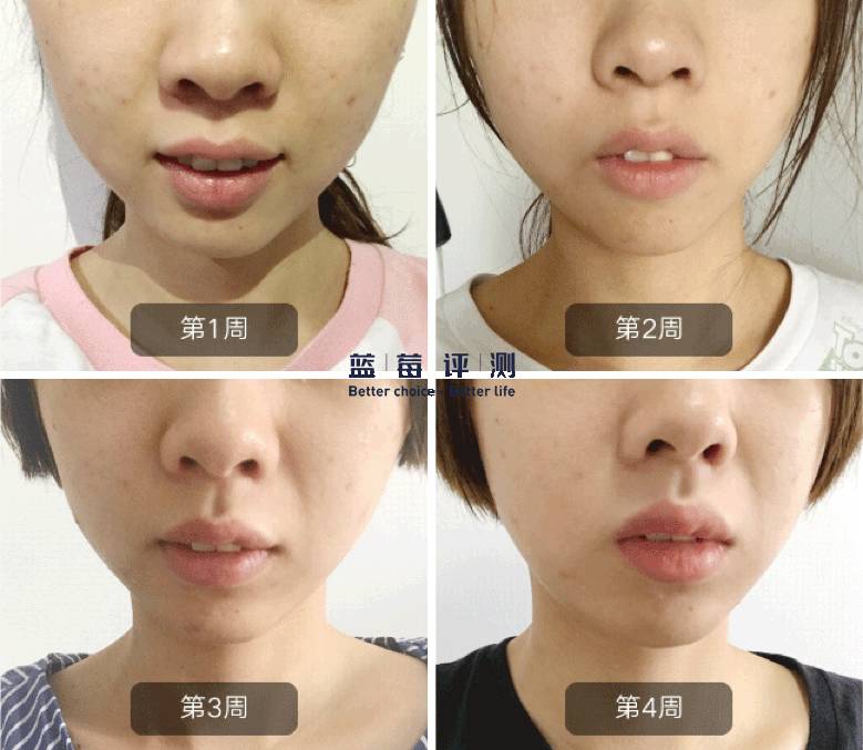 有哪些比较好用的美容仪可以推荐,最好用的有效的美容仪