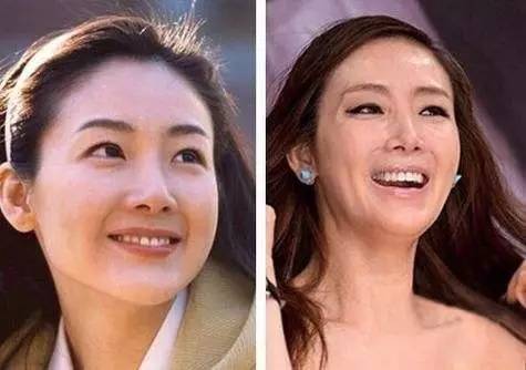 25岁如何平衡抗老和补水,过了25岁就开始用抗皱护肤品吗