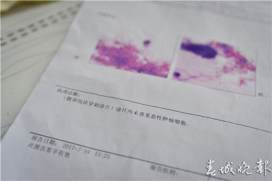 霍奇金淋巴瘤彻底治愈需要多少钱,9岁男孩白血病治疗费用