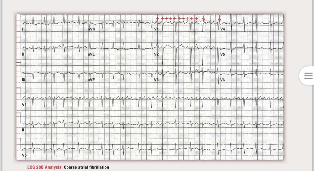 读心有术216,读心有术131期