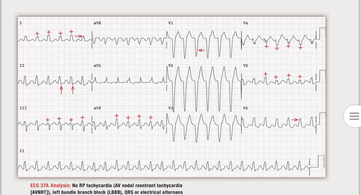 读心有术205期视频,读心有术