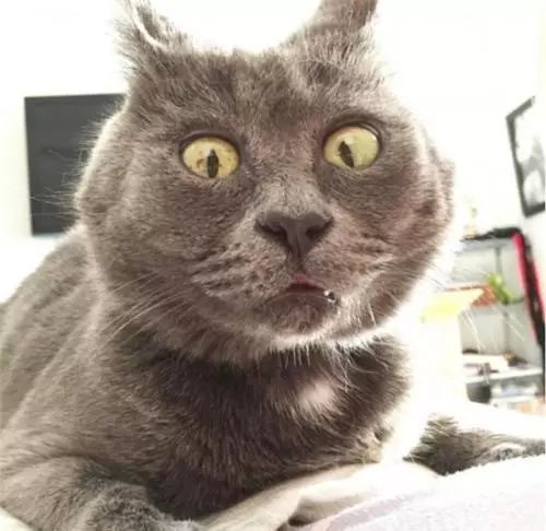 小疖子，有时可能也会要命！