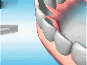 爱牙口腔日,爱牙日华西口腔医院