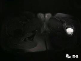 髋部疼痛做什么检查,左髋部疼痛待查病例