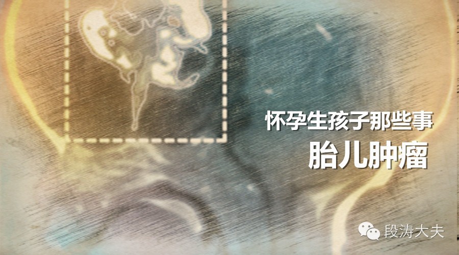 胎儿没出生就长了肿瘤,怀孕20周孩子有肿瘤