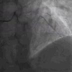 典型病例及处理方法,典型病例分析及治疗方法