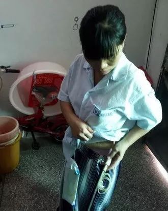 女子被撞索赔误工费几十万,被撞私了之后病情再严重怎么办