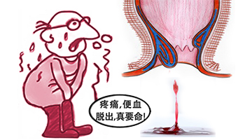 便秘偶尔出血要紧吗,产后便秘出血怎么办
