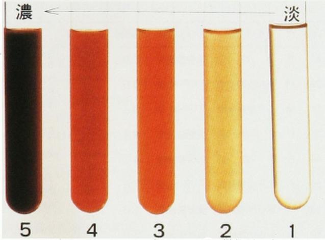 肾病恶化至尿毒症风险有多大,肾病危害教学视频