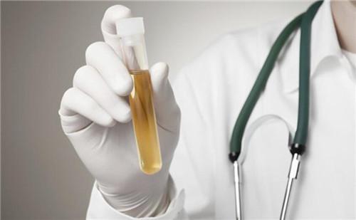 尿检指标科学解读！