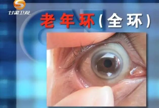 眼睛周围长一圈红色疙瘩红肿发烧,眼睛附近长了一片红疹子