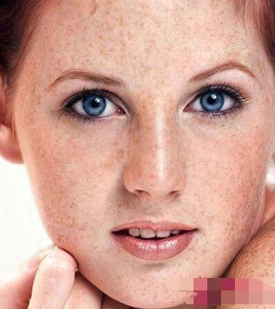 告别有斑的肌肤,告别斑点肌肤问题