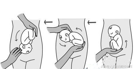 胎宝宝太懒不爱动,孕晚期臀位宝宝可以顺产吗