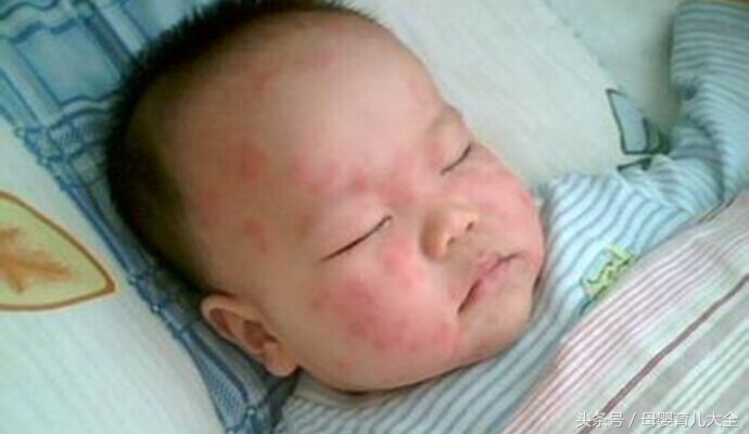 回了趟老家身上起疙瘩,小孩回农村老家身上长疙瘩非常痒