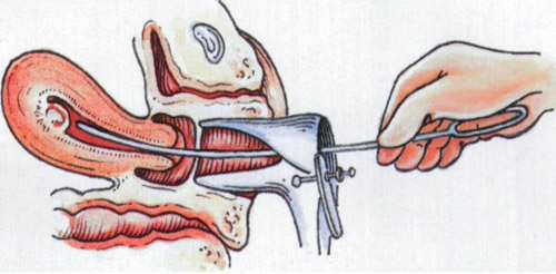 女人这事做多了,想再怀孕生子都是不可能的事情,珍惜身体才是好