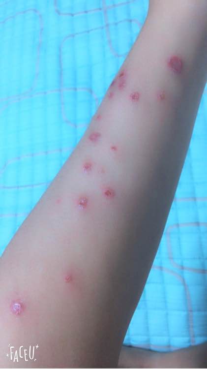 去朋友家，抱养了一只小猫，喂养两周后，我们的噩梦开始了！