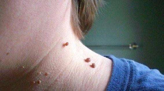 理发师号称养生治疾病,骗女子*款贷**20万办疗程,到底是什么病