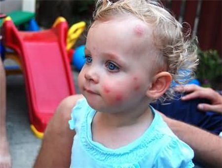 驱蚊液成分怎么选,驱蚊液注意事项避免儿童接触